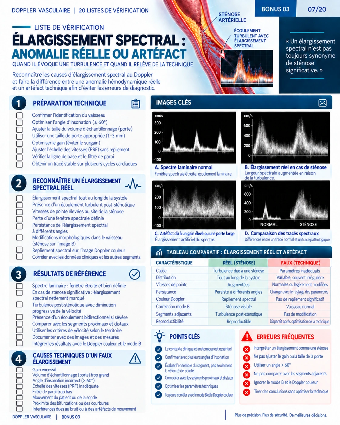 Page 7 : Élargissement spectral. Aperçu de présentation en français du support numérique de Doppler vasculaire.
