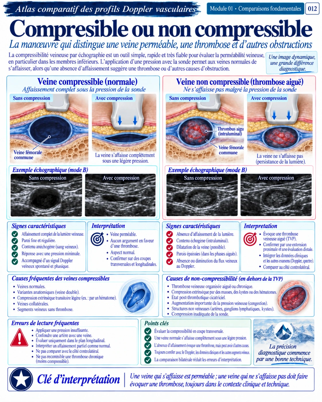 Page 12 : Compressible ou non compressible. Aperçu de présentation en français du support numérique de Doppler vasculaire.