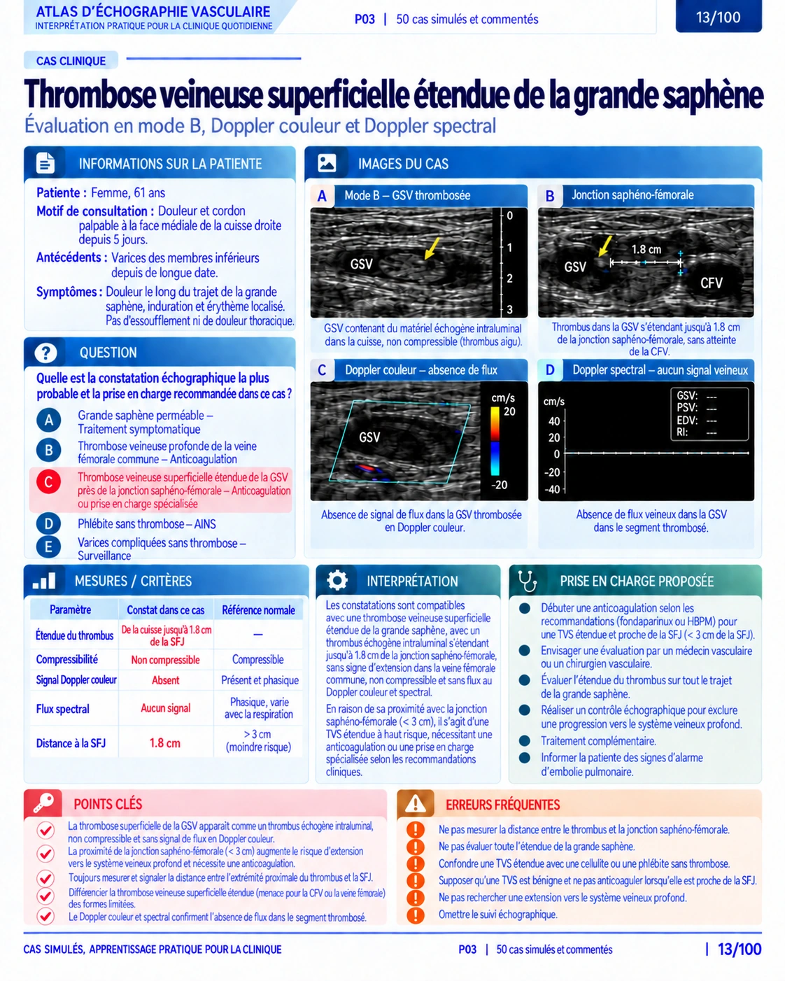 Page 13 : Cas : thrombose veineuse superficielle. Aperçu de présentation en français du support numérique de Doppler vasculaire.