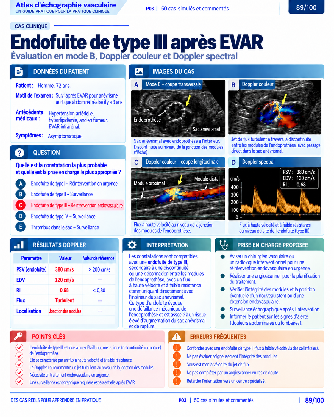 Page 89 : Cas : endofuite de type III après EVAR. Aperçu de présentation en français du support numérique de Doppler vasculaire.