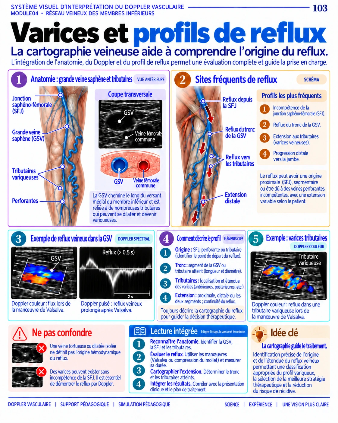 Page 103 : Varices et profils de reflux. Aperçu de présentation en français du support numérique de Doppler vasculaire.